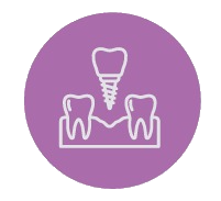 Implantes dentales